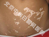 пưҽԺ